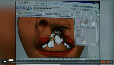 科技助力医疗慈善--微笑列车唇腭裂虚拟手术模
